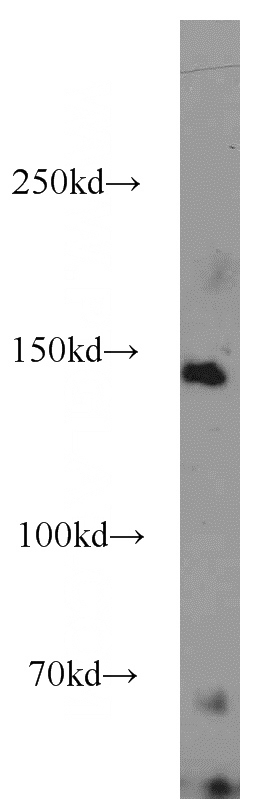 K-562 cells were subjected to SDS PAGE followed by western blot with Catalog No:107905(AFF1-Specific antibody) at dilution of 1:300