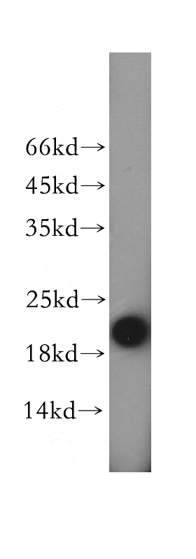 human placenta tissue were subjected to SDS PAGE followed by western blot with Catalog No:112855(MRPS28 antibody) at dilution of 1:400
