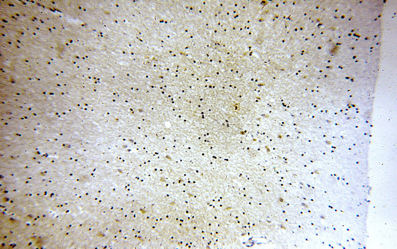 Immunohistochemical of paraffin-embedded human brain using Catalog No:115754(SV2B antibody) at dilution of 1:100 (under 10x lens)