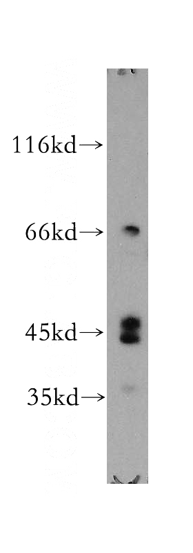 Apoptosised HeLa cells were subjected to SDS PAGE followed by western blot with Catalog No:110064(DPF2 antibody) at dilution of 1:300