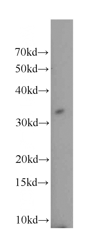 K-562 cells were subjected to SDS PAGE followed by western blot with Catalog No:116291(TNFRSF13B antibody) at dilution of 1:500