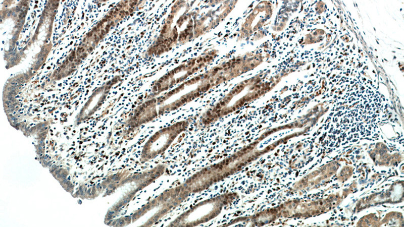 Immunohistochemical of paraffin-embedded human stomach using Catalog No:108792(C7orf58 antibody) at dilution of 1:100 (under 10x lens)