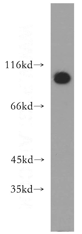HeLa cells were subjected to SDS PAGE followed by western blot with Catalog No:108348(ATP2C1 antibody) at dilution of 1:400