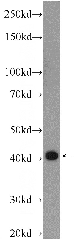 mouse skeletal muscle tissue were subjected to SDS PAGE followed by western blot with Catalog No:116268(TPM3 Antibody) at dilution of 1:600