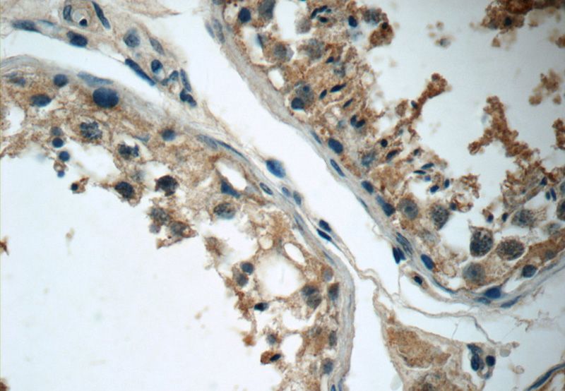Immunohistochemistry of paraffin-embedded human testis tissue slide using Catalog No:116938(ZDHHC13 Antibody) at dilution of 1:50 (under 40x lens)