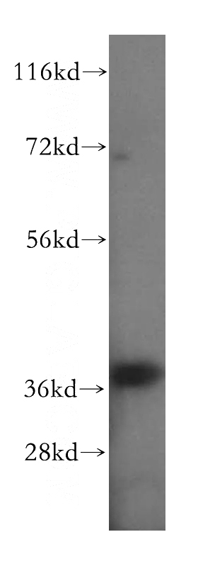 human skeletal muscle tissue were subjected to SDS PAGE followed by western blot with Catalog No:111062(GPD1L antibody) at dilution of 1:500
