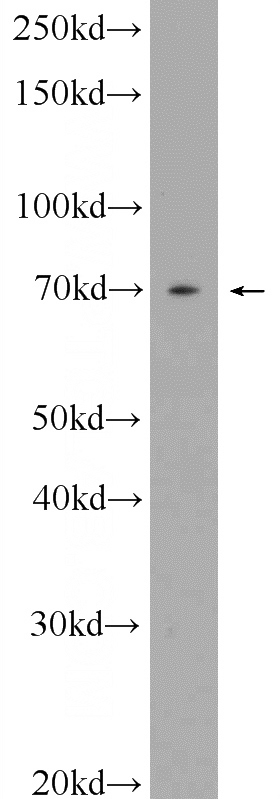 MDA-MB-453s cells were subjected to SDS PAGE followed by western blot with Catalog No:112698(MMP13 Antibody) at dilution of 1:600