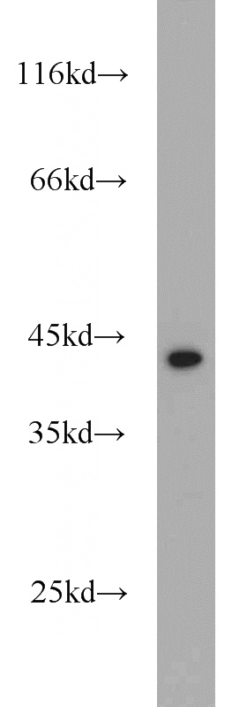HeLa cells were subjected to SDS PAGE followed by western blot with Catalog No:109892(DEPDC6 antibody) at dilution of 1:1000