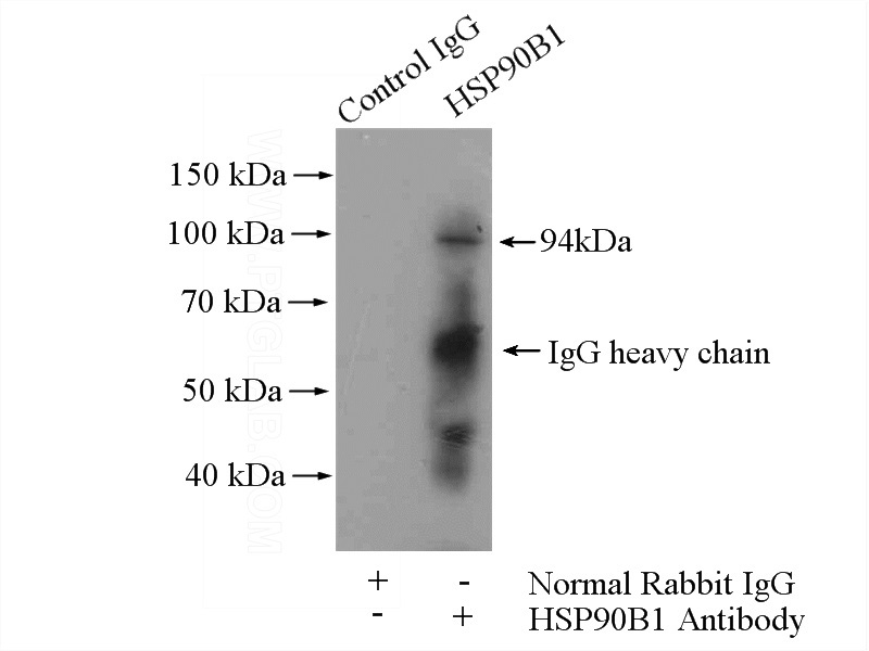 IP Result of anti-GRP94 (IP:Catalog No:111222, 4ug; Detection:Catalog No:111222 1:500) with MCF-7 cells lysate 4000ug.
