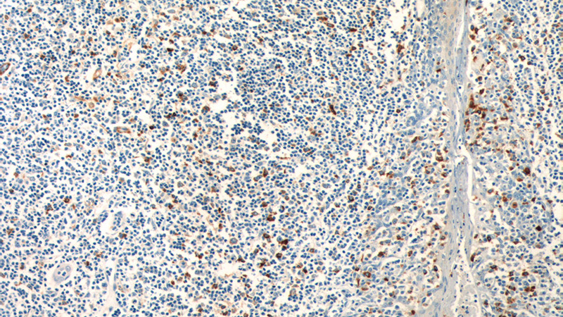 Immunohistochemistry of paraffin-embedded human tonsillitis tissue slide using Catalog No:113483(PADI4 Antibody) at dilution of 1:200 (under 10x lens)