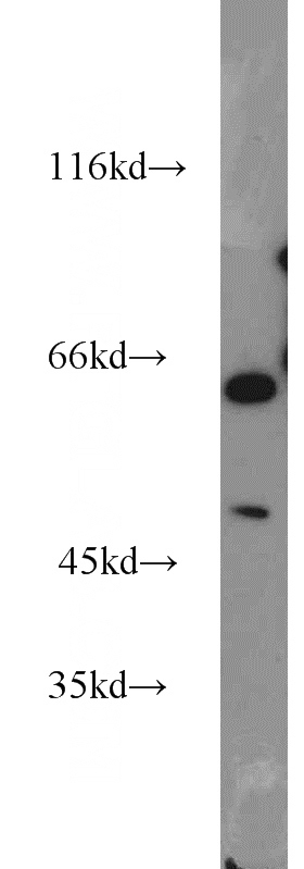 mouse kidney tissue were subjected to SDS PAGE followed by western blot with Catalog No:107689(ACP2 antibody) at dilution of 1:500