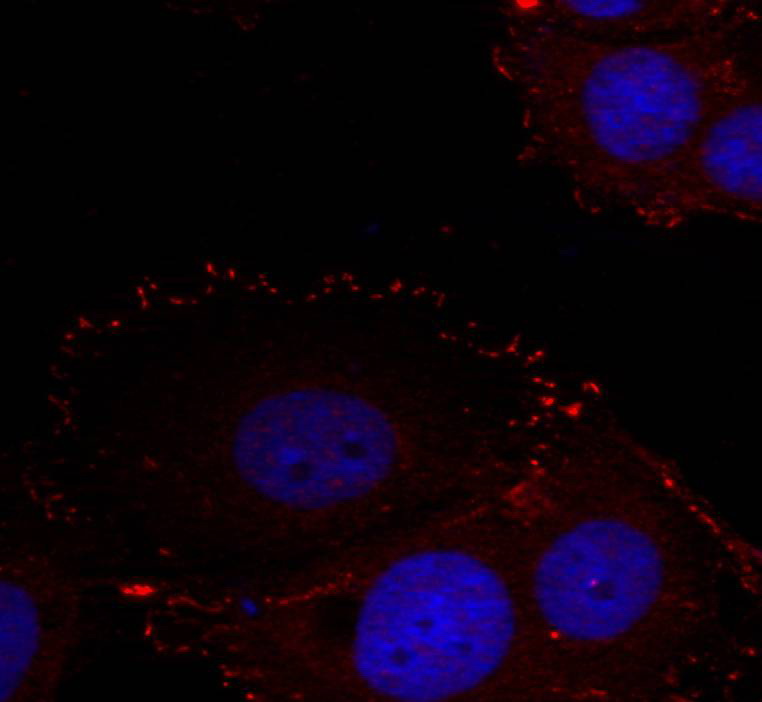Immunofluorescence staining of methanol-fixed Hela cells using FAK (phospho-Tyr576/Tyr577) Antibody .