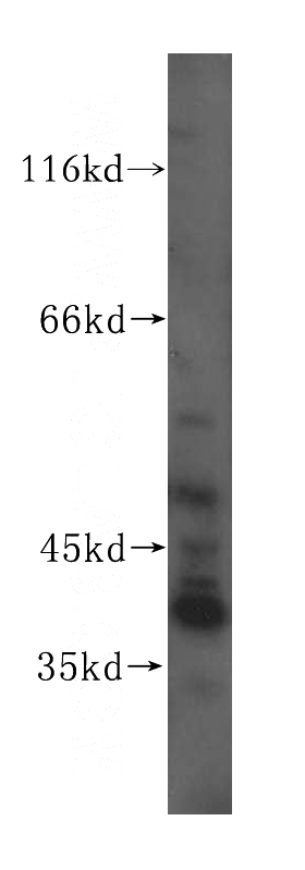 HeLa cells were subjected to SDS PAGE followed by western blot with Catalog No:115898(TCEA3 antibody) at dilution of 1:500