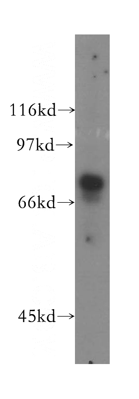 human brain tissue were subjected to SDS PAGE followed by western blot with Catalog No:111248(GUCY1A3 antibody) at dilution of 1:400