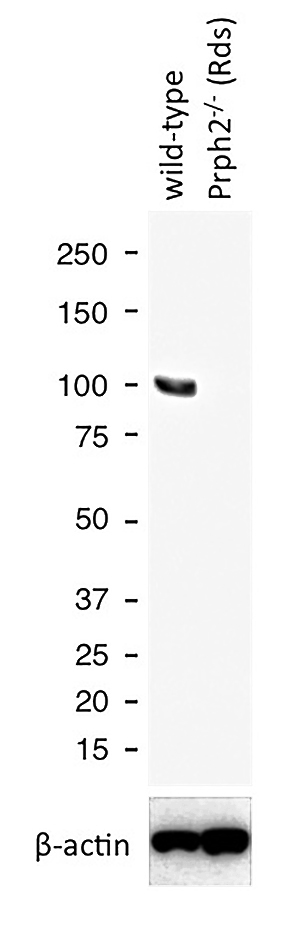 WB results of PDE6A antibody (Catalog No:113665) with WT mouse Eye and Prph2 (Rds) mutant mouse Eye (Negative control). Courtesy of Seongjin Seo, PhD, University of Iowa College of Medicine.