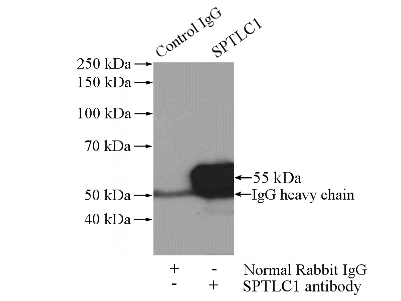 IP Result of anti-SPTLC1 (IP:Catalog No:115655, 4ug; Detection:Catalog No:115655 1:500) with HEK-293 cells lysate 880ug.