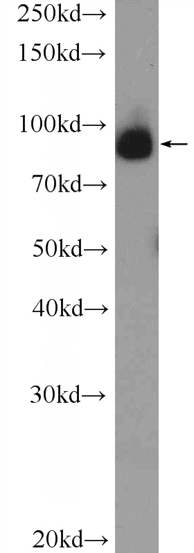 PC-3 cells were subjected to SDS PAGE followed by western blot with Catalog No:108712(C2orf3 Antibody) at dilution of 1:600