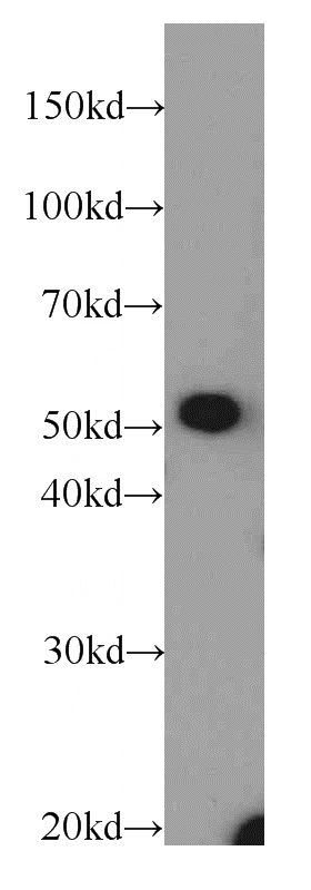 mouse kidney tissue were subjected to SDS PAGE followed by western blot with Catalog No:115304(SLC16A12 antibody) at dilution of 1:100