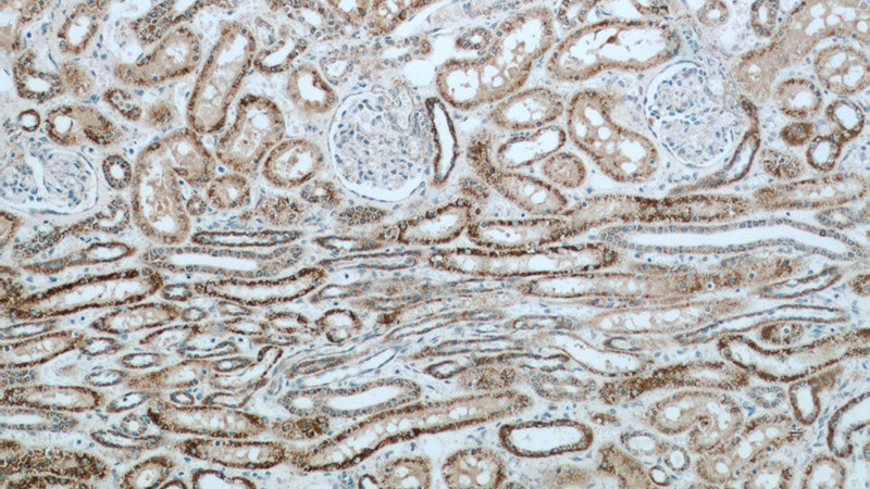 Immunohistochemical of paraffin-embedded human kidney using Catalog No:111845(INPP5J antibody) at dilution of 1:50 (under 10x lens)