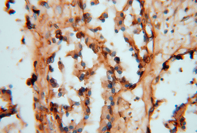 Immunohistochemical of paraffin-embedded human prostate using Catalog No:112184(LDHB antibody) at dilution of 1:100 (under 40x lens)