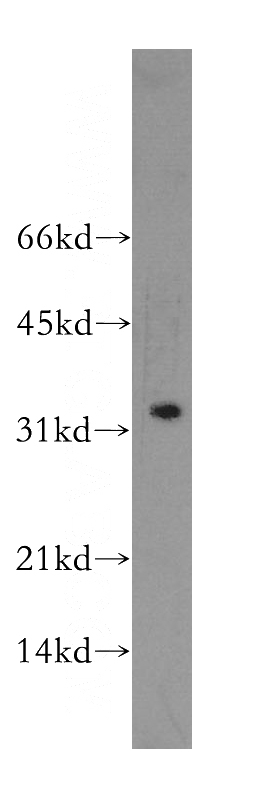 HL-60 cells were subjected to SDS PAGE followed by western blot with Catalog No:111322(GZMB antibody) at dilution of 1:500