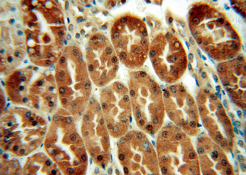 Immunohistochemical of paraffin-embedded human kidney using Catalog No:112215(LHPP antibody) at dilution of 1:100 (under 40x lens)