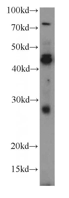HEK-293 cells were subjected to SDS PAGE followed by western blot with Catalog No:115528(SPACA3 antibody) at dilution of 1:300