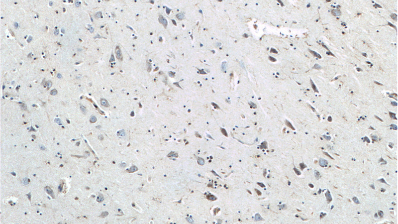 Immunohistochemistry of paraffin-embedded human brain tissue slide using Catalog No:115857(TAU Antibody) at dilution of 1:200 (under 10x lens)