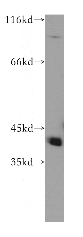 HeLa cells were subjected to SDS PAGE followed by western blot with Catalog No:114495(RABEPK antibody) at dilution of 1:500