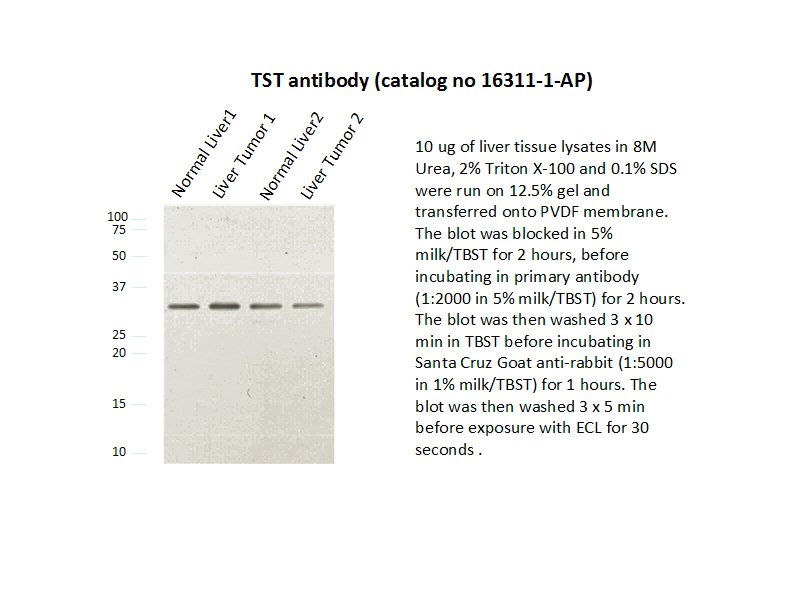 WB result of anti-TST(Catalog No:116373) in Liver by Dr. Seow Chong Lee.