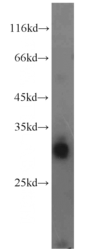 mouse liver tissue were subjected to SDS PAGE followed by western blot with Catalog No:112182(LDHAL6A antibody) at dilution of 1:500