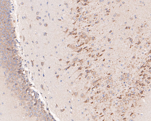 Fig2: Immunohistochemical analysis of paraffin-embedded rat brain tissue using anti-KCNB1 antibody. The section was pre-treated using heat mediated antigen retrieval with Tris-EDTA buffer (pH 8.0-8.4) for 20 minutes.The tissues were blocked in 5% BSA for 30 minutes at room temperature, washed with ddH2O and PBS, and then probed with the primary antibody ( 1/50) for 30 minutes at room temperature. The detection was performed using an HRP conjugated compact polymer system. DAB was used as the chromogen. Tissues were counterstained with hematoxylin and mounted with DPX.