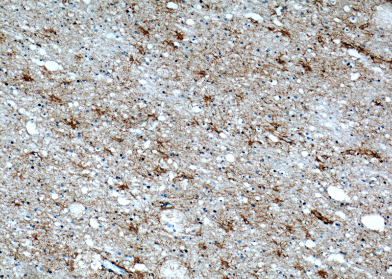 Immunohistochemical of paraffin-embedded human brain using Catalog No:108047(AQP4 antibody) at dilution of 1:50 (under 10x lens)