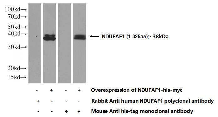 Transfected HEK-293 cells were subjected to SDS PAGE followed by western blot with Catalog No:113066(NDUFAF1 Antibody) at dilution of 1:1000