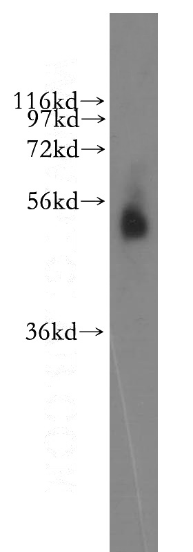 human liver tissue were subjected to SDS PAGE followed by western blot with Catalog No:113565(RASSF9 antibody) at dilution of 1:500