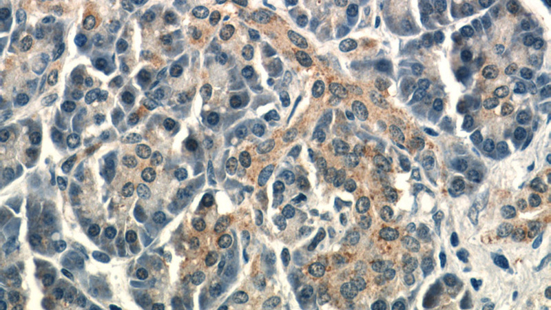Immunohistochemistry of paraffin-embedded human pancreas tissue slide using Catalog No:116500(PEO1 Antibody) at dilution of 1:50