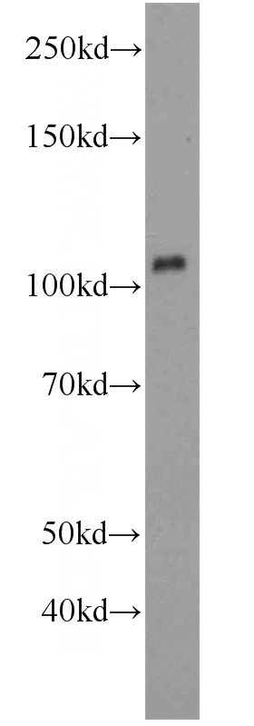 MCF7 cells were subjected to SDS PAGE followed by western blot with Catalog No:107846(AHR antibody) at dilution of 1:1000