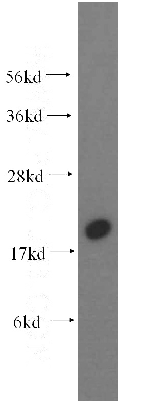 K-562 cells were subjected to SDS PAGE followed by western blot with Catalog No:112962(NAT13 antibody) at dilution of 1:300