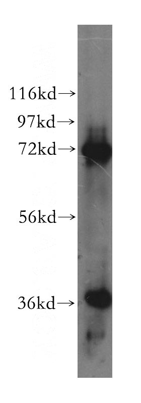 human brain tissue were subjected to SDS PAGE followed by western blot with Catalog No:112099(KLHL22 antibody) at dilution of 1:300