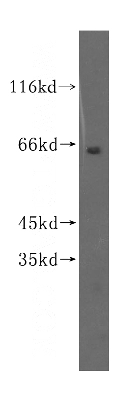 PC-3 cells were subjected to SDS PAGE followed by western blot with Catalog No:115172(SGOL1 antibody) at dilution of 1:400