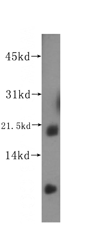 mouse ovary tissue were subjected to SDS PAGE followed by western blot with Catalog No:114976(SAT2 antibody) at dilution of 1:500