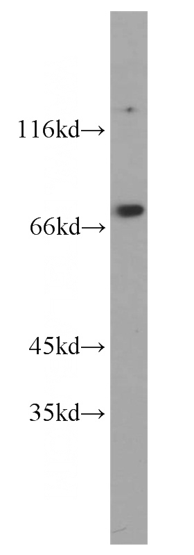 HEK-293 cells were subjected to SDS PAGE followed by western blot with Catalog No:116046(THoc1 antibody) at dilution of 1:500