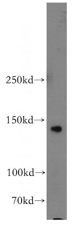 Jurkat cells were subjected to SDS PAGE followed by western blot with Catalog No:115505(SORCS2 antibody) at dilution of 1:500