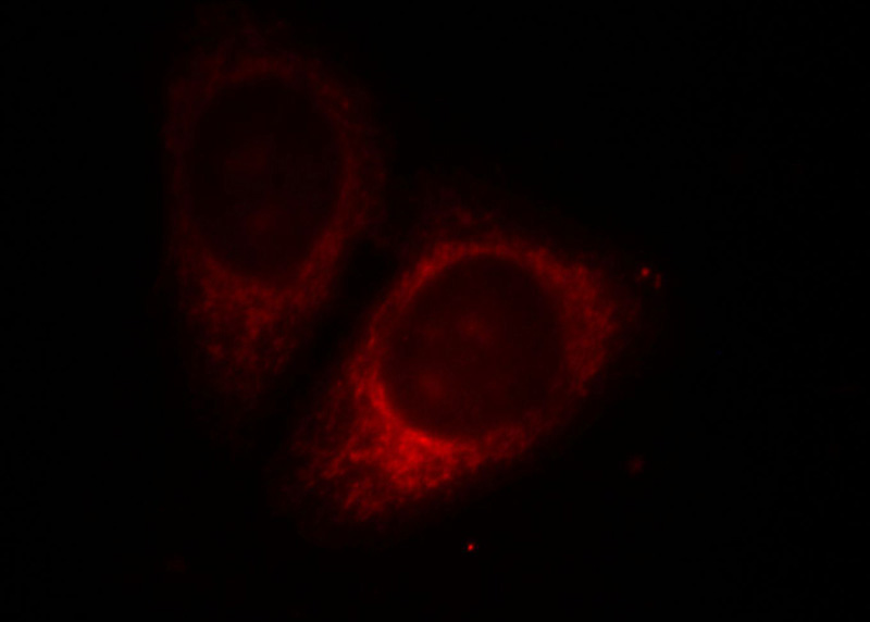 Immunofluorescent analysis of HepG2 cells, using WSB1 antibody Catalog No:116971 at 1:25 dilution and Rhodamine-labeled goat anti-rabbit IgG (red).