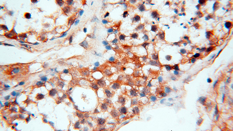 Immunohistochemical of paraffin-embedded human testis using Catalog No:112135(KRT80 antibody) at dilution of 1:200 (under 40x lens)