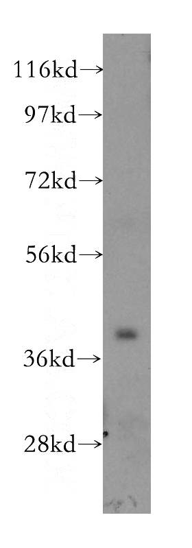 mouse skeletal muscle tissue were subjected to SDS PAGE followed by western blot with Catalog No:115701(STBD1 antibody) at dilution of 1:1000