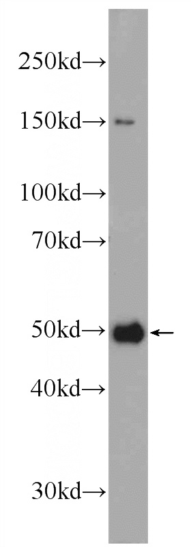 K-562 cells were subjected to SDS PAGE followed by western blot with Catalog No:112575(ME2 Antibody) at dilution of 1:600