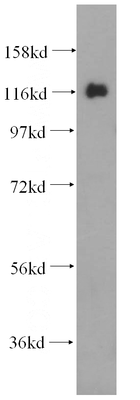 Jurkat cells were subjected to SDS PAGE followed by western blot with Catalog No:116610(USP36 antibody) at dilution of 1:200