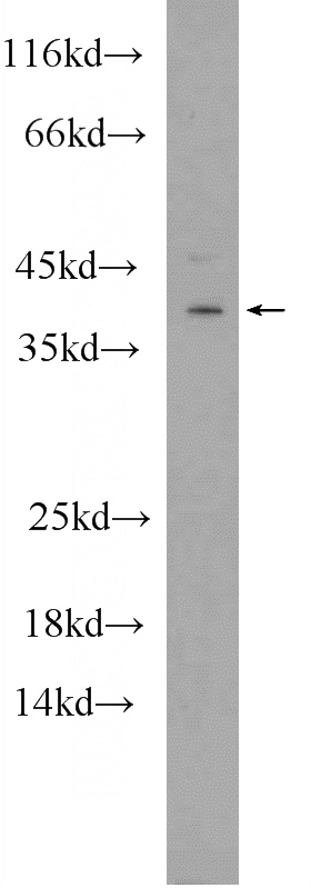 rat brain tissue were subjected to SDS PAGE followed by western blot with Catalog No:111300(HES5 Antibody) at dilution of 1:300