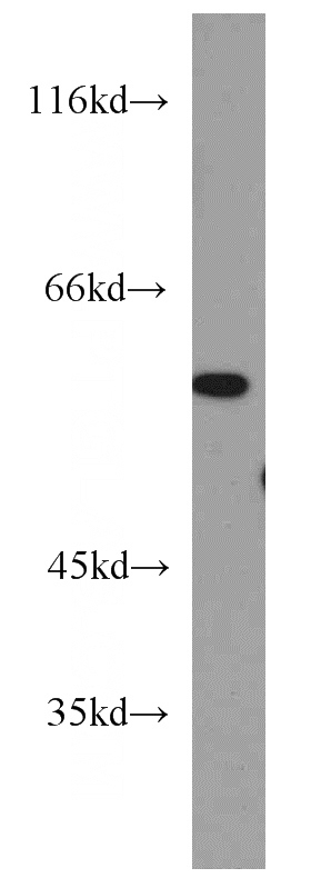 Y79 cells were subjected to SDS PAGE followed by western blot with Catalog No:112195(LENG9 antibody) at dilution of 1:800